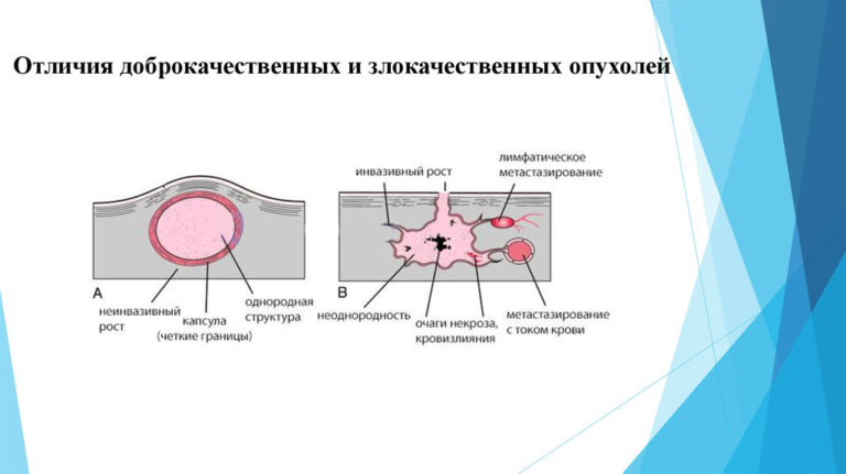 Нейроэндокринные опухоли общие принципы диагностики и лечения руководство