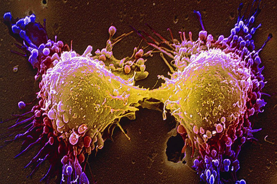 А вы знаете современные теории возникновения раковой опухоли?
