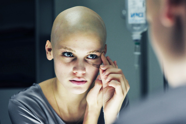 Когда начинают выпадать волосы после химиотерапии?