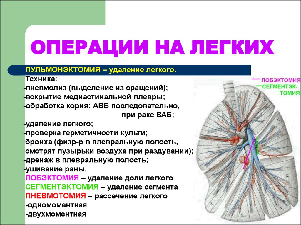 Восстановление после удаления доли легкого лучшая схема