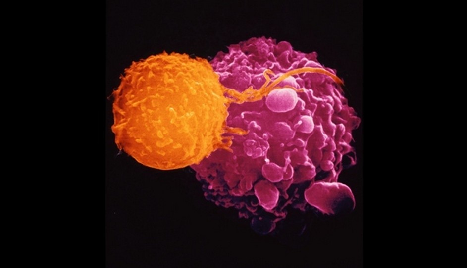 Исследования ученых в борьбе с раком: вирус и манноза